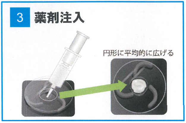 ピレスロイドや有機リン抵抗性のチャバネゴキブリだけでなくクロゴキブリ、ワモンゴキブリにも効果的！速効成分フィプロニルを配合した液剤散布に代わる高性能ゴキブリ駆除用ベイトジェル（防除用医薬部外品）マックスフォースマグナムの通信販売：テクノ株式会社、巣ごと一網打尽！ベイト剤でシンプル＆クリーン施工！フィプロニルの高い駆除効果！ベイトジェル＋ベイトステーションならではのシンプル＆クリーン施工、マックスフォース マグナムは、液剤散布のような施工の際の養生が不要であり、薬剤臭の心配がないため、時間帯を選ばないクリーンな施工が可能です。液剤散布と違い、必要なところにベイトステーション（誤食防止容器）を設置するだけ。ベイトステーションに入れて使うので安全性が高く、ベイトジェルが食べつくされていたら追加注入が可能。ベイトジェルが残った場合でも、ゴキブリ生息密度の高い場所に移動させることで無駄なく使い切れて、容易に回収できます。マックスフォースマグナムは食べて効く！高い喫食性。一口で十分な致死量。ゴキブリが好む餌成分と水分を多く配合したバイエル独自のアクアジェル処方。たった一口で致死量の150倍以上の薬剤を食べる！チャバネゴキブリ、クロゴキブリ、ワモンゴキブリ。マックスフォースマグナムは触れて効く！高い接触致死効果！マックスフォースマグナムに触れただけで死んだゴキブリ。マックスフォースマグナムは伝わって効く！フィプロニルの伝搬効果により高密度の現場でも駆除可能！ドミノ効果、フィプロニル。マックスフォースマグナムは効果長持ち！安定した喫食性が維持できる製剤で新たに侵入してきたゴキブリも駆除。•誤食防止容器1個に対して、本品を誤食防止容器の上部の薬剤注入口から薬量目安線（約0.4g）まで注入し、注入された容器をゴキブリの生息場所や出没する場所（例えば飲食店調理場、台所、食品加工工場等）に1m2あたり1個の割合で配置してください。マックスフォースマグナムは誤食防止容器に入れて使用するゴキブリ駆除用ベイトジェルです。速効性の殺虫成分フィプロニルを配合し小型のゴキブリ（飲食店などの店舗に多いチャバネゴキブリ）や大型のゴキブリ（一般家庭や外部侵入の多いクロゴキブリ、ワモンゴキブリ）などを誘引し駆除します。まずは容器を切り取り線に沿って折り、切り離してください。（容器本体が割れないように注意して切り離してください。）先端部分（上記１）を折り付属の注入チップをねじ込みプランジャーをセットして下さい。この際にプランジャーを押し過ぎると先端から薬剤が出ますので注意して下さい。使用後は注入チップを外し、付属のキャップでフタをして下さい。外した注入チップは内部まできれいに清掃して下さい。（清掃を怠ると薬剤が固まり使えなくなる事があります。）誤食防止容器上部の穴にシリンジの注入チップの先端を置くまで差込み、プランジャーを押して容器の円形マークに沿うよう所定の容量（約０，４ｇ）を注入して下さい。誤食防止容器は繰り返し使用が可能です。使用中に容器の薬剤が食べ尽くされていたら薬剤を追加注入して下さい。薬剤が注入された容器はゴキブリの生息場所や出没する場所（例えば飲食店の調理場、台所、食品加工工場）に１平方メートル当たり１個の割合で設置して下さい。注１：容器の設置場所やその周辺にはゴキブリに対して忌避性の高い液剤やスプレー等をかけないで下さい。注２：使用途中のシリンジの場合、まれにシリンジ先端部分に残った製品が固化している場合があります。この際は針金等で固化しているものを除いてご使用ください。ピレスロイドや有機リン抵抗性のチャバネゴキブリだけでなくクロゴキブリ、ワモンゴキブリにも効果的！速効成分フィプロニルを配合した液剤散布に代わる高性能ゴキブリ駆除用ベイトジェル（防除用医薬部外品）マックスフォースマグナムの通信販売：テクノ株式会社